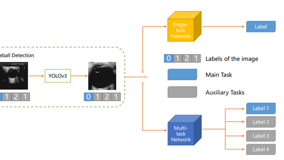 Automatic Cataract Detection with Multi-Task Learning.